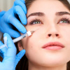 Tiêm filler vùng dưới mắt: Những lưu ý nhất định không được bỏ qua