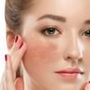 Tìm hiểu sản phẩm giúp giảm thâm nám đến từ thương hiệu Eucerin