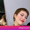 Rapper Pháo sau khi phẫu thuật thẩm mỹ