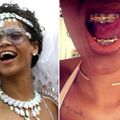 Grillz - Mốt đính kim cương lên răng cực chất của các ngôi sao-11