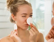 7 điều cần ghi nhớ khi điều trị da mụn
