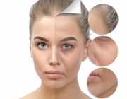 5 sản phẩm chứa collagen cho một làn da trẻ trung, căng mọng