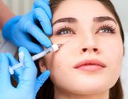 Tiêm filler vùng dưới mắt: Những lưu ý nhất định không được bỏ qua