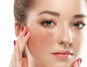 Tìm hiểu sản phẩm giúp giảm thâm nám đến từ thương hiệu Eucerin