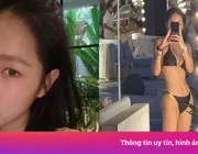 Nữ ca sĩ quá gầy sau khi giảm 10 kg