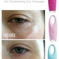 Máy massage mắt Foreo Iris