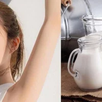 Cách chữa da cháy nắng hiệu quả tại nhà-2