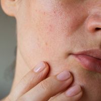 Những dấu hiệu cho thấy da cần được tẩy tế bào chết-4