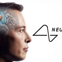 Neuralink của Elon Musk chuẩn bị thử nghiệm cấy chip vào não người
