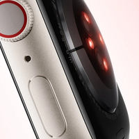 Apple Watch Series 10
