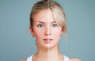 Những thói quen làm hại làn da của bạn