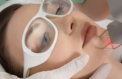 Tất tần tật những điều bạn cần biết trước khi làm liệu trình laser trên da