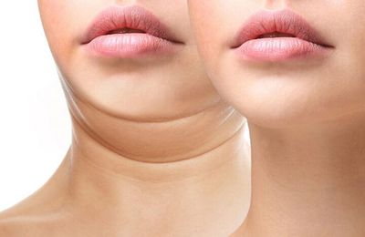 5 thói quen tưởng quen thuộc nhưng lại khiến bạn có nọng cằm