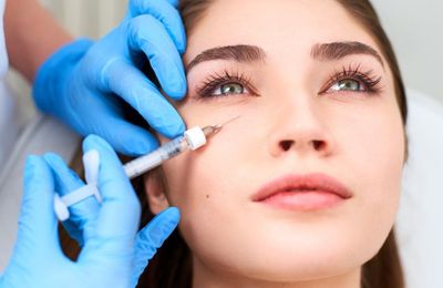 Tiêm filler vùng dưới mắt: Những lưu ý nhất định không được bỏ qua