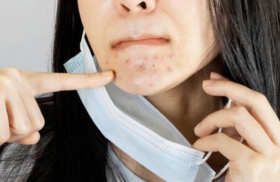 Khám phá mặt nạ dưỡng da nửa mặt dùng để đắp bên dưới lớp khẩu trang