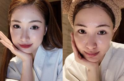 Hòa Minzy nói về việc phẫu thuật thẩm mỹ
