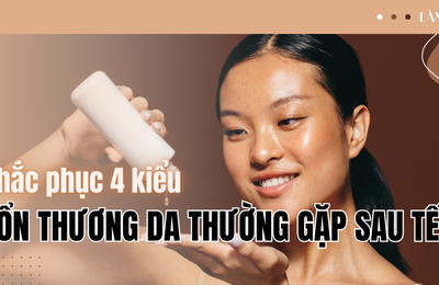 Cách khắc phục 4 kiểu tổn thương da thường gặp sau Tết