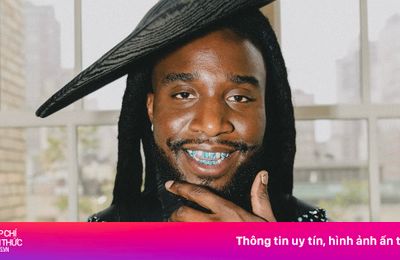 Rapper 'nhuộm' răng cùng màu mặt số đồng hồ xa xỉ