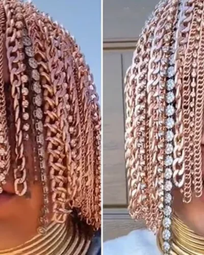 Nam rapper cấy tóc bằng dây chuyền vàng