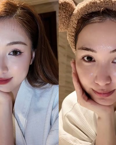 Hòa Minzy nói về việc phẫu thuật thẩm mỹ