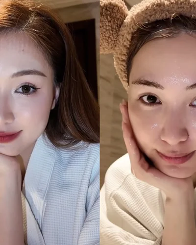 Hòa Minzy nói về việc phẫu thuật thẩm mỹ