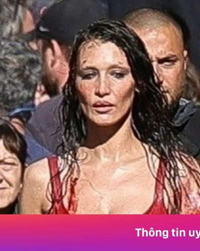 Hình ảnh gây lo lắng của Bella Hadid