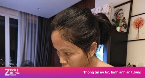 H'Hen Niê gây lo lắng
