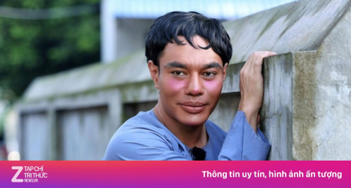 Bài học cho Lê Dương Bảo Lâm