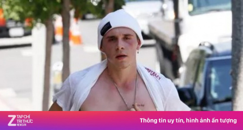 Lý do Brooklyn Beckham chặn bố mẹ trên mạng xã hội