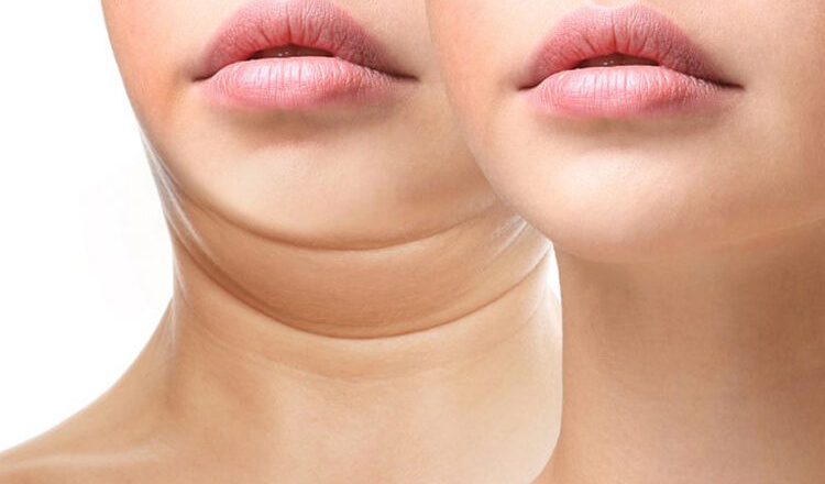 5 thói quen tưởng quen thuộc nhưng lại khiến bạn có nọng cằm