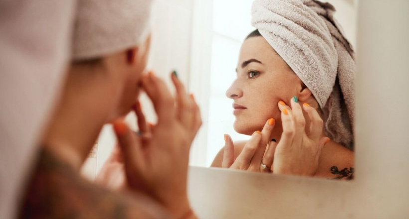 10 Cách làm hết thâm mụn nhanh nhất tại nhà