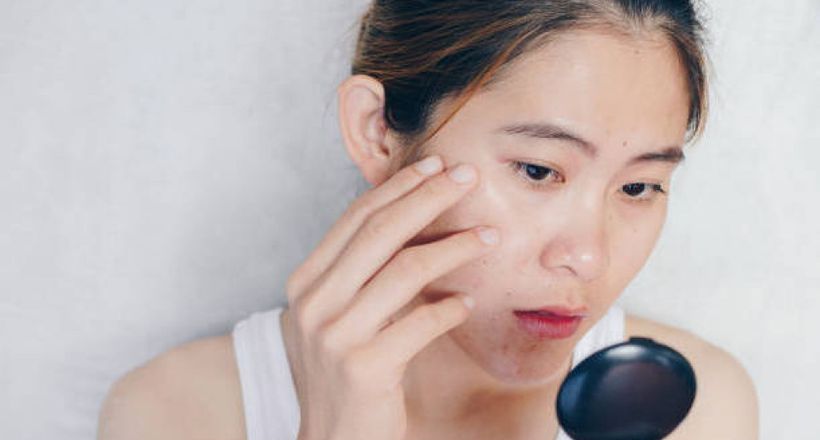 Những sai lầm cần tránh khi chăm sóc làn da dầu
