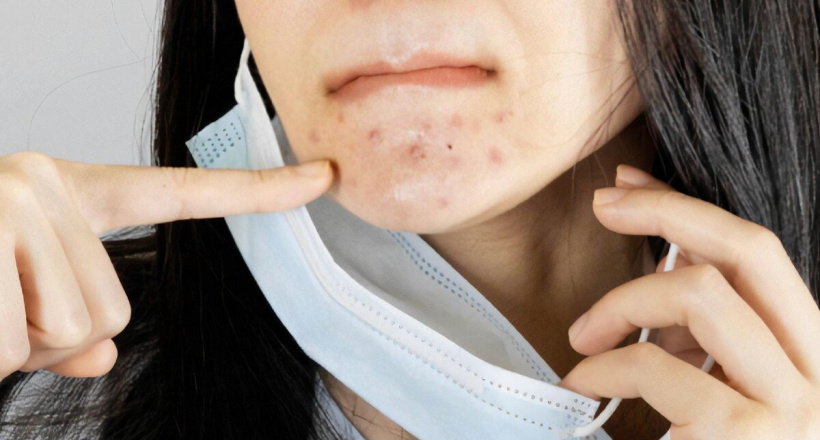 Khám phá mặt nạ dưỡng da nửa mặt dùng để đắp bên dưới lớp khẩu trang