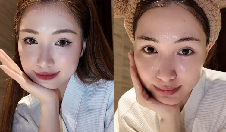 Hòa Minzy nói về việc phẫu thuật thẩm mỹ