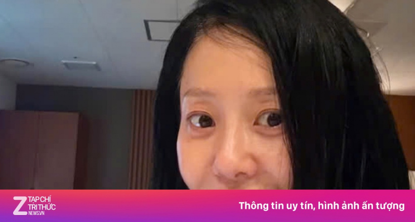 Tình cảnh báo động của Go Hyun Jung