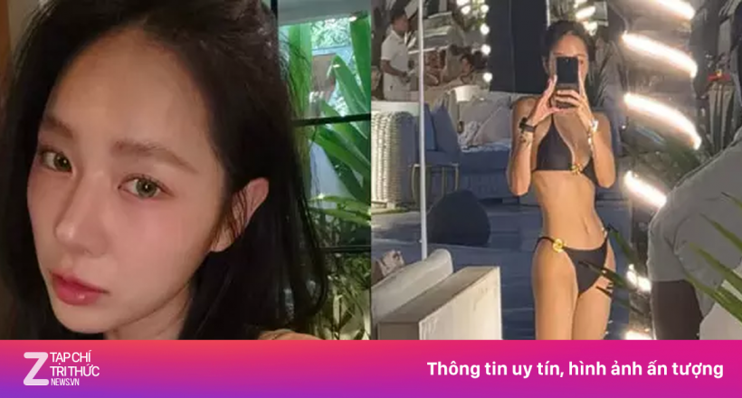 Nữ ca sĩ quá gầy sau khi giảm 10 kg