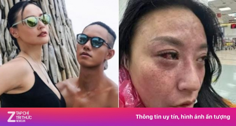 Diễn viên Tâm Vân bị chồng kém 16 tuổi bạo hành