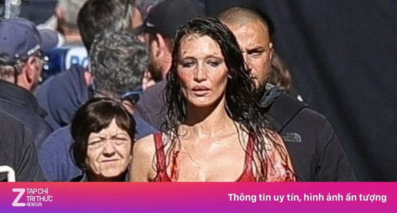 Hình ảnh gây lo lắng của Bella Hadid