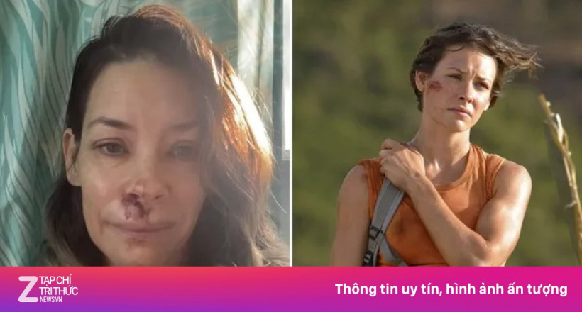 Diễn viên 'Người Kiến' ngất xỉu trên bãi biển