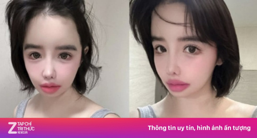 Park Bom dừng hoạt động