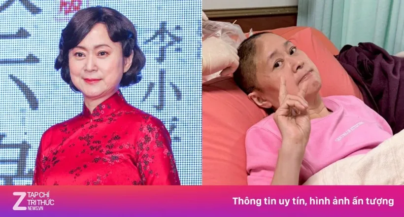 Diễn viên 'Vườn sao băng' sau khi mất một phần hộp sọ