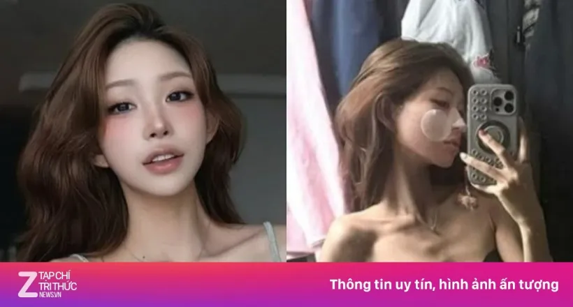 Tình trạng đáng báo động của con gái Choi Jin Sil