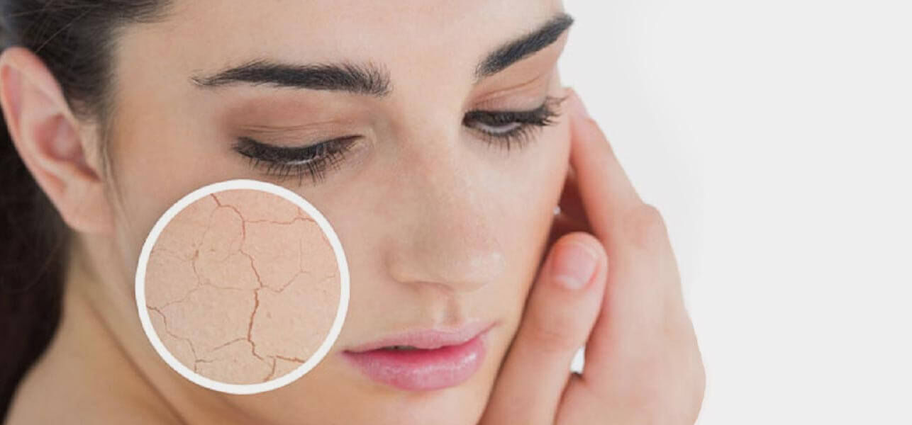10-Top-Tips-For-Dry-Skin.jpg