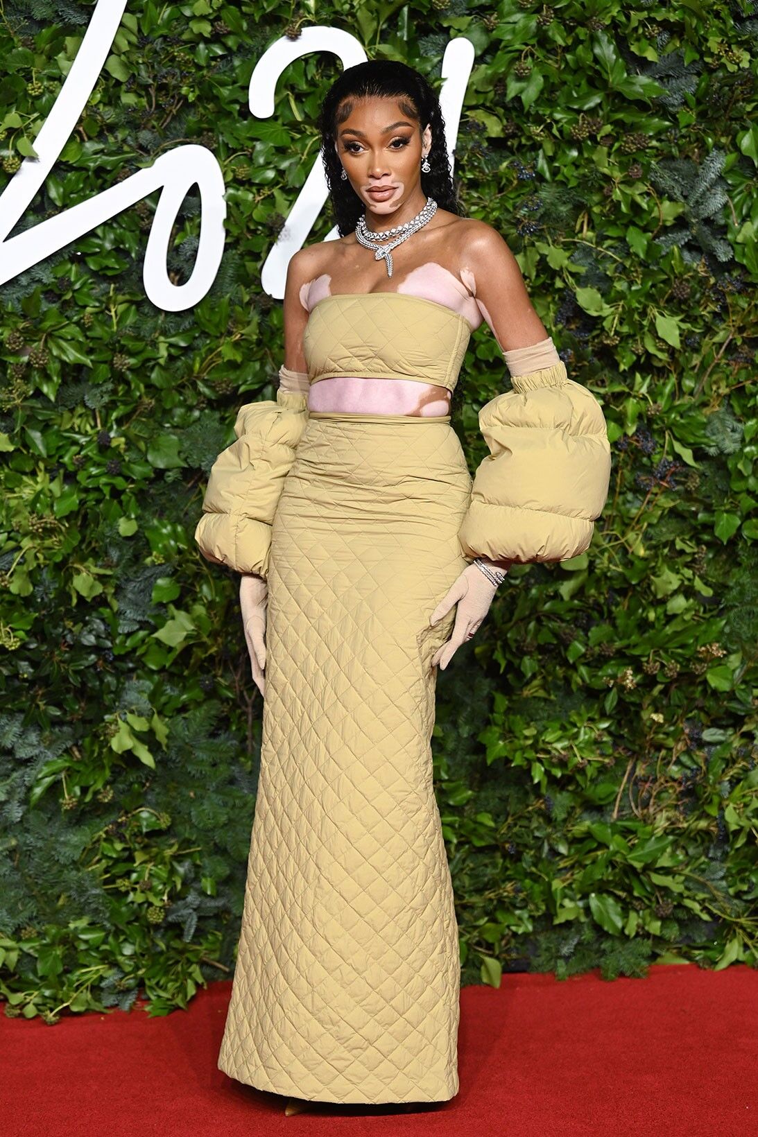 Winnie Harlow