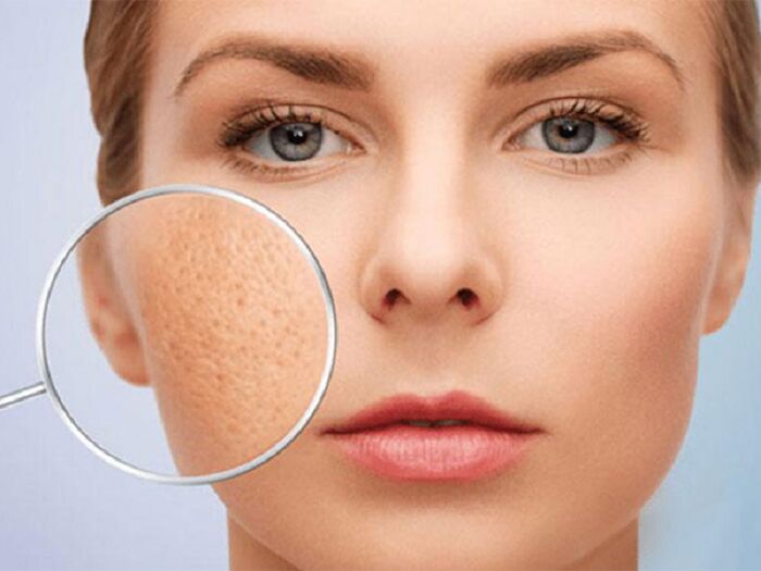 Bí quyết se khít lỗ chân lông an toàn, hiệu quả ngay tại nhà