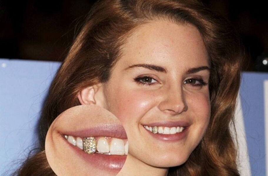 Grillz - Mốt đính kim cương lên răng cực chất của các ngôi sao-7