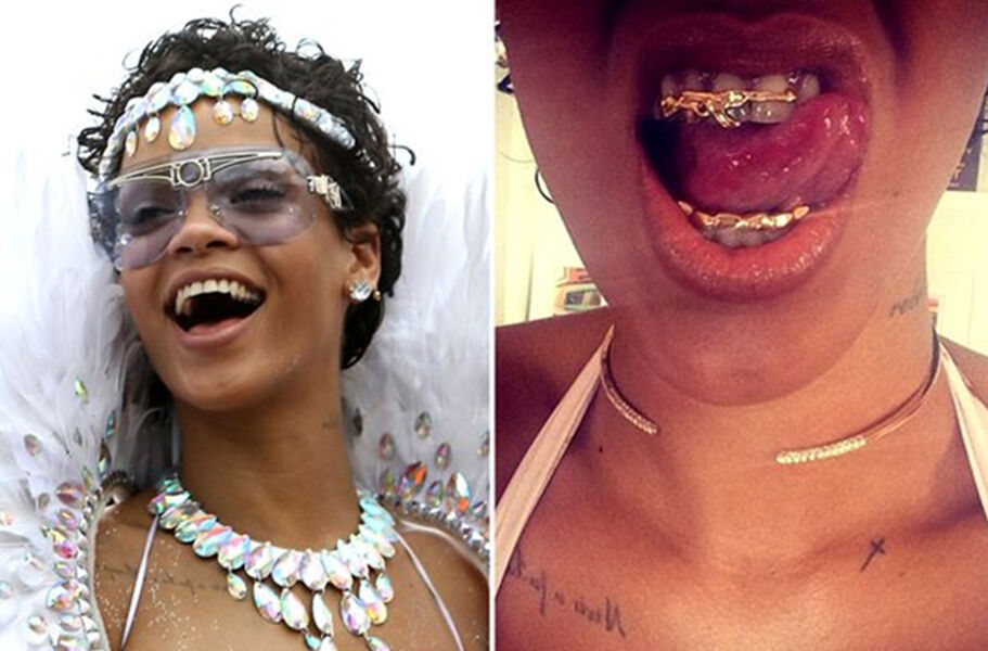 Grillz - Mốt đính kim cương lên răng cực chất của các ngôi sao-11
