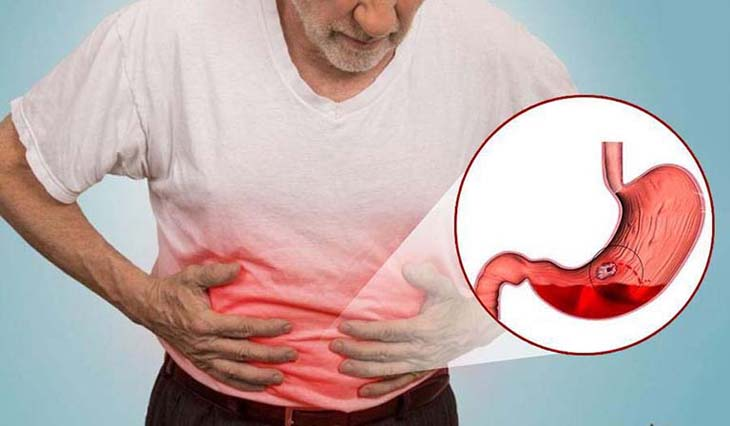 1 loại củ nhiều vitamin C hơn cả cam, chanh giúp hạ đường huyết