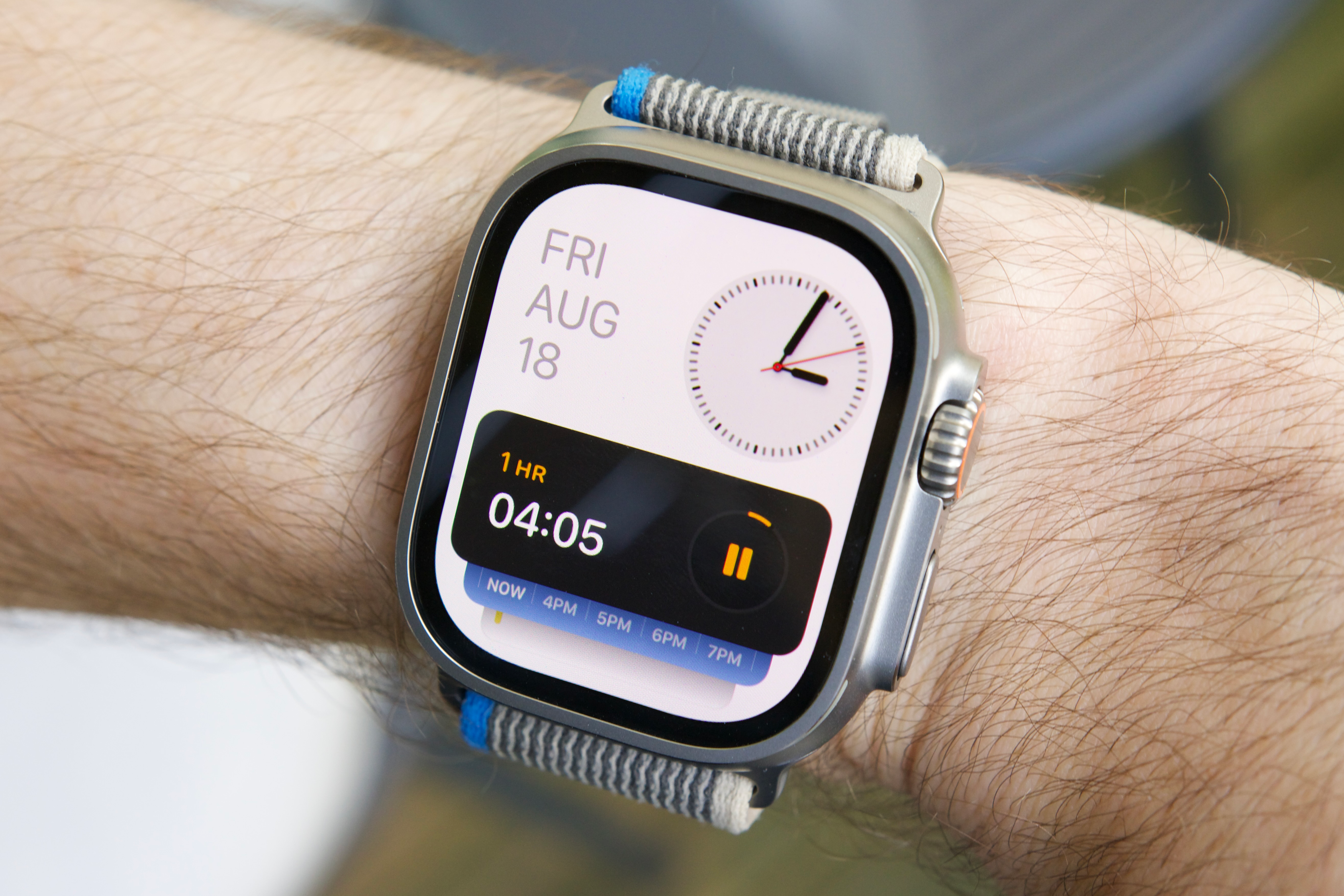Apple Watch Series 10